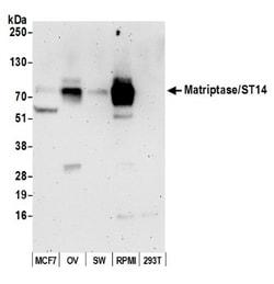 Matriptase/ST14 Antibody, Novus Biologicals 0.1mg; Unlabeled:Antibodies,